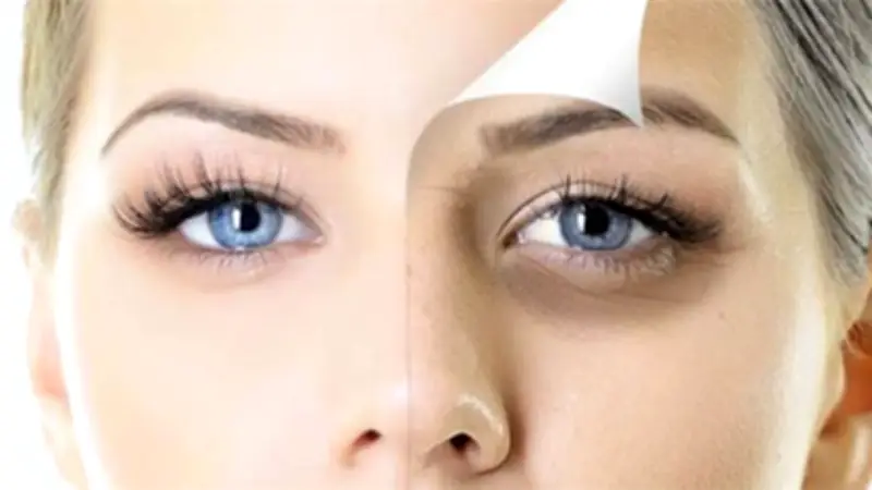 أسباب غير متوقعة لظهور الهالات السوداء تحت العينين وكيفية الوقاية منها