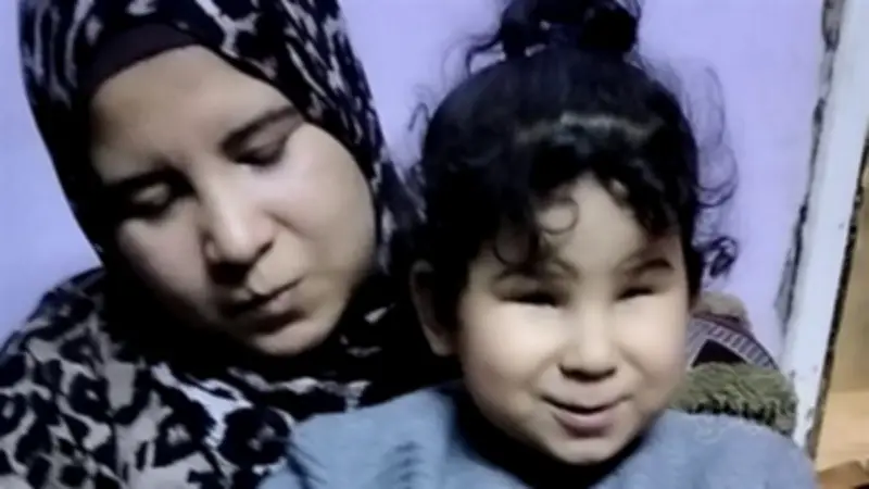 مأساة سجدة: طفلة المنوفية المولودة بدون قرنية وأسرتها تناشد التدخل لإنقاذ بصرها