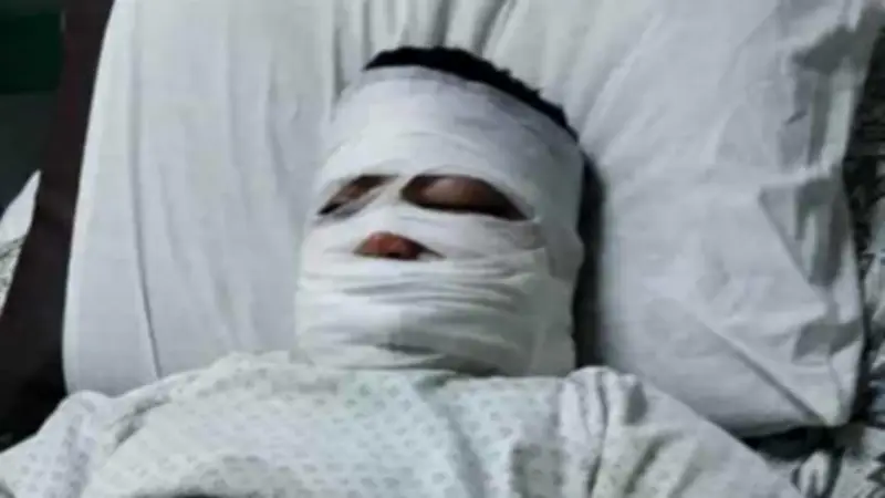 طفل يتعرض لحروق خطيرة بسقوط زيت مغلي عليه في بنها أثناء شراء السحور