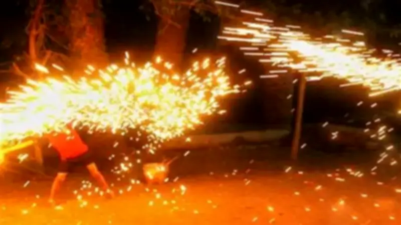 طفل في التاسعة يصاب بحروق خطيرة بعد إشعال سلك المواعين في منشأة ناصر