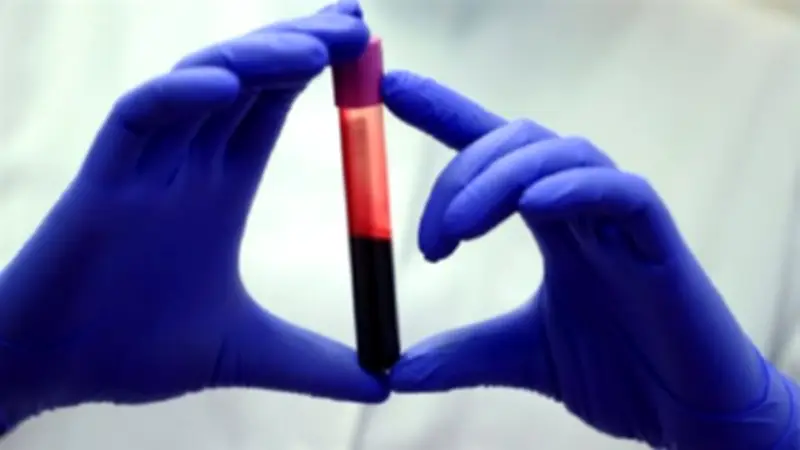 اختبار دم ثوري يتنبأ بفرص بقاء كبار السن على قيد الحياة