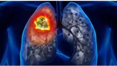 170 ألف إصابة سرطان سنوياً في مصر.. نواب يطالبون بسياسة وطنية للأبحاث وتسريع التحول الرقمي