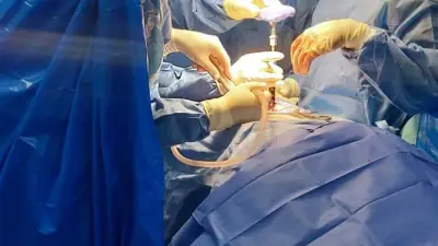 تخصيص 3 مليارات جنيه لإنهاء قوائم الانتظار الجراحية فوراً ضمن حزمة اجتماعية بـ40 مليار