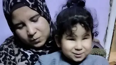 مأساة سجدة: طفلة المنوفية المولودة بدون قرنية وأسرتها تناشد التدخل لإنقاذ بصرها