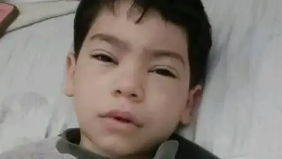 تطورات جديدة في حالة الطفل المصاب بطلق خرطوش في القليوبية: تفاصيل الواقعة والإجراءات الأمنية