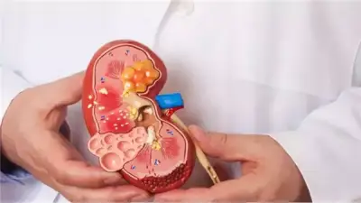 عميد معهد الكلى يحذر: العرقسوس في رمضان يهدد بارتفاع ضغط الدم وإرهاق الكلى