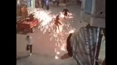 طفل يصاب بحروق خطيرة.. سلك المواعين المشتعل يثير الرعب وتحذيرات من كوارث محتملة