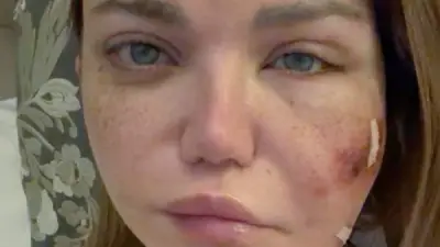 ياسمين الخطيب تخضع لجراحة دقيقة بعد إصابتها بعدوى بكتيرية في وجهها