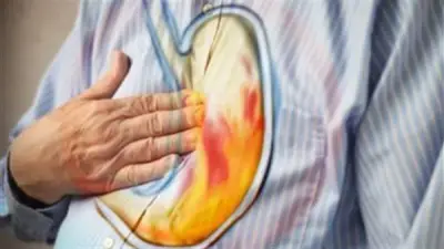 أسباب حرقة المعدة بعد الإفطار في رمضان ونصائح فعالة للوقاية منها