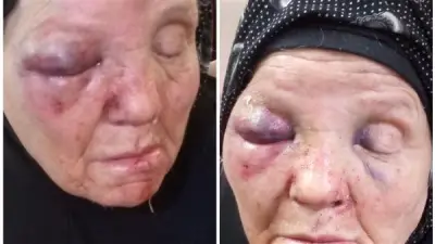 ضبط شاب بتهمة الاعتداء على والدته المسنة في الغربية وطفلة تصاب بشرخ في الجمجمة