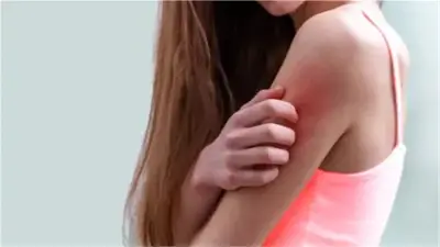 البلاجرا: مرض نقص فيتامين B3 الذي يهدد الجلد والأعصاب والهضم