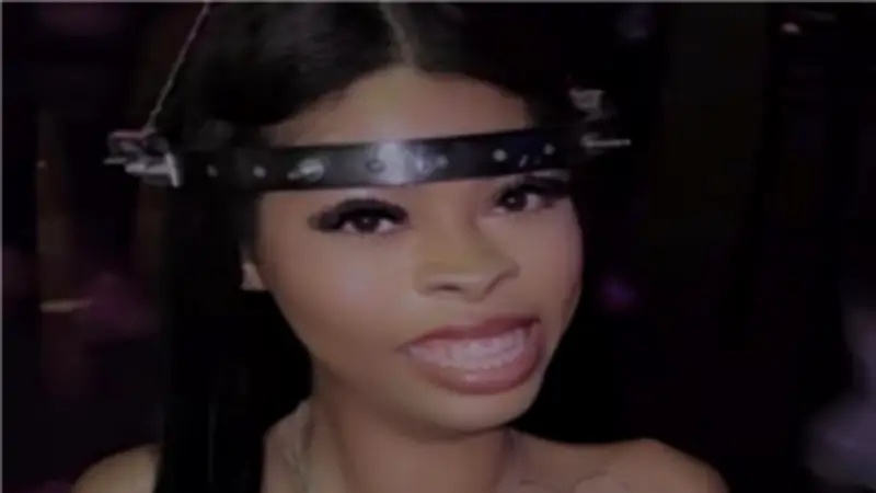 فتاة تتحدى المرض النادر بـ15 مسمارًا في جمجمتها لتعيش حتى 27 عامًا