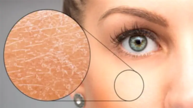 نصائح ذهبية لحماية بشرتك من الجفاف خلال الصيام وموجة البرد القارس