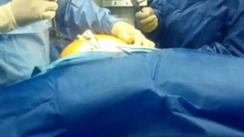 نجاح جراحة دقيقة لشاب في دمياط بعد حادث طريق أدى إلى كسور في الوجه والعين