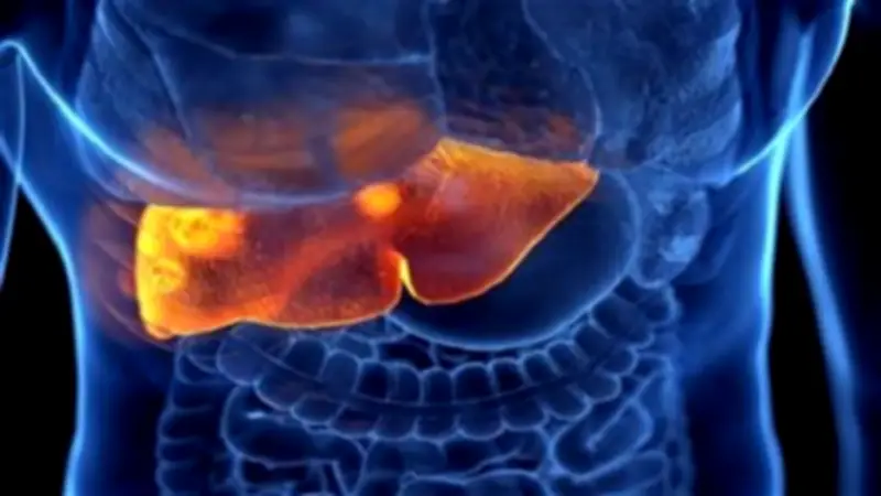 نصائح غذائية أساسية لمرضى الكبد الدهني خلال شهر رمضان المبارك