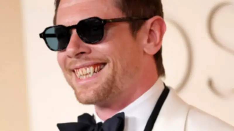 جاك أوكونيل يظهر بأنياب مصاصي الدماء في حفل الأوسكار وسط منافسة قوية