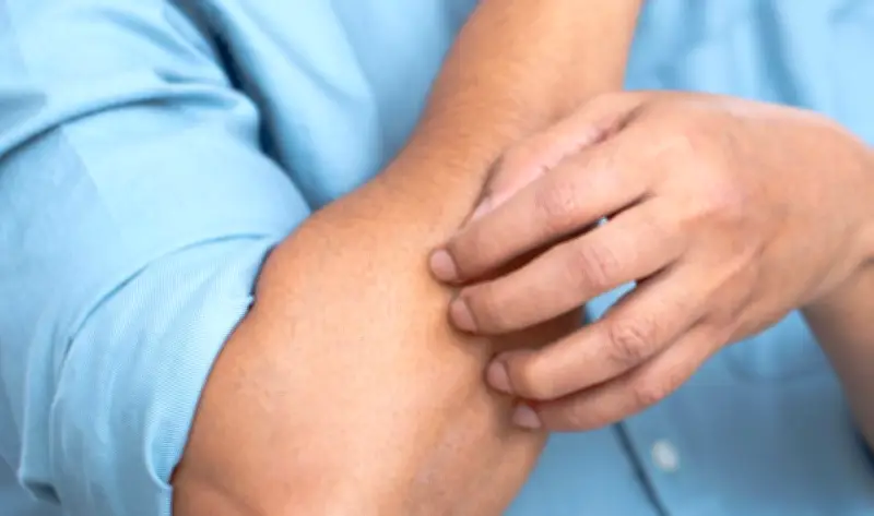 احترس.. حكّة الجلد قد تكون مؤشرًا على تغيرات خطيرة داخل الجسم