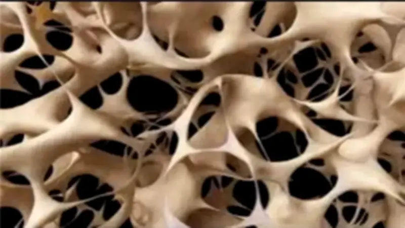 نصائح طبية فعالة لعلاج هشاشة العظام وتقوية الهيكل العظمي