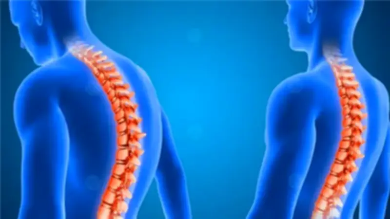 وزارة الصحة تحذر من ارتفاع حالات التهابات العمود الفقري بسبب الجلوس الخاطئ والإفراط في استخدام الموبايل