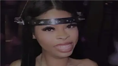 فتاة تتحدى المرض النادر بـ15 مسمارًا في جمجمتها لتعيش حتى 27 عامًا