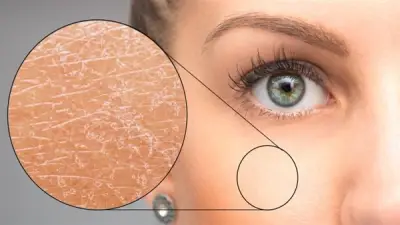 نصائح ذهبية لحماية بشرتك من الجفاف خلال الصيام وموجة البرد القارس