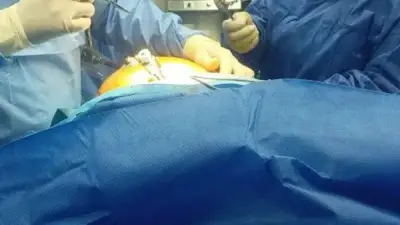 نجاح جراحة دقيقة لشاب في دمياط بعد حادث طريق أدى إلى كسور في الوجه والعين