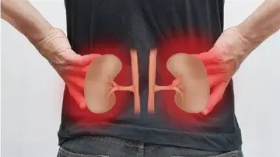 نصائح طبية لمرضى الكلى في رمضان: حالات تستوجب الإفطار وتجنب المخاطر