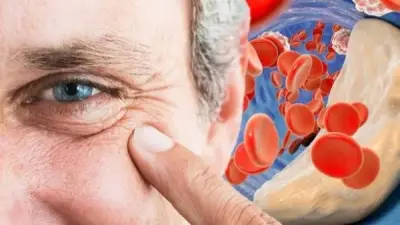 تمر المجدول: سلاح غير متوقع في رمضان لخفض الكوليسترول الضار بالدم