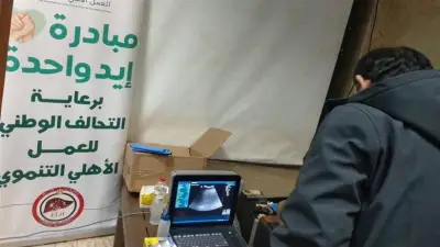 التحالف الوطني ينظم قافلة طبية للكشف المبكر عن أمراض الكبد في المنصورة
