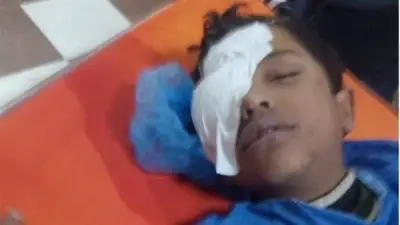 مديرية تعليم المنوفية تحيل حادثة فقدان طالب لإحدى عينيه داخل مدرسة للتحقيق