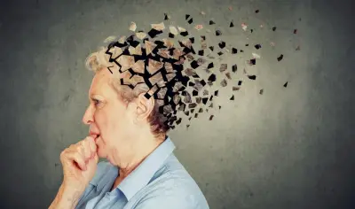 دراسة جديدة تكشف عن أهمية علاج هشاشة العظام في تقليل خطر الوفاة المبكرة