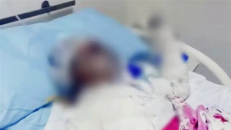 طفلة الشرقية تودع الحياة بعد حروق مميتة.. والنيابة تفتح تحقيقًا موسعًا