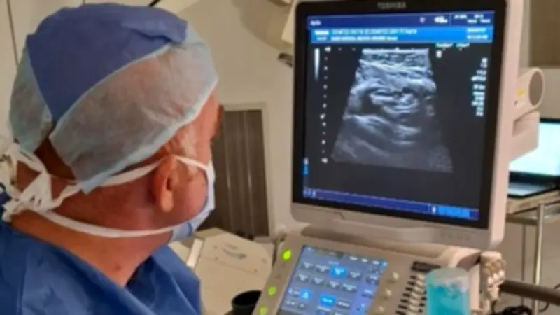 مستشفى بدر الجامعي ينهي معاناة نزيف مزمن لثلاث سنوات بتقنية القسطرة التداخلية