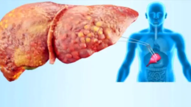 طريقة ثورية لزراعة الكبد تخلص المرضى من أدوية تثبيط المناعة لسنوات