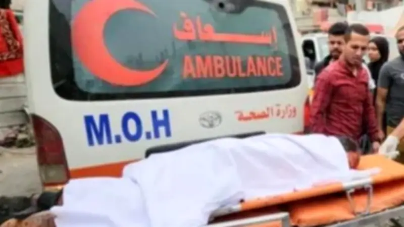 مدير مستشفى يحذر من انتشار فيروس الجدري المائي بين أطفال غزة وسط إجراءات عاجلة