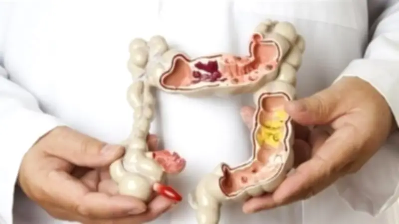 تهيج القولون العصبي: أعراضه المزعجة والأطعمة الممنوعة لتفادي الألم الحاد