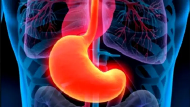 احذر هذه المأكولات.. ترفع الحموضة وتسبب حرقة في المعدة