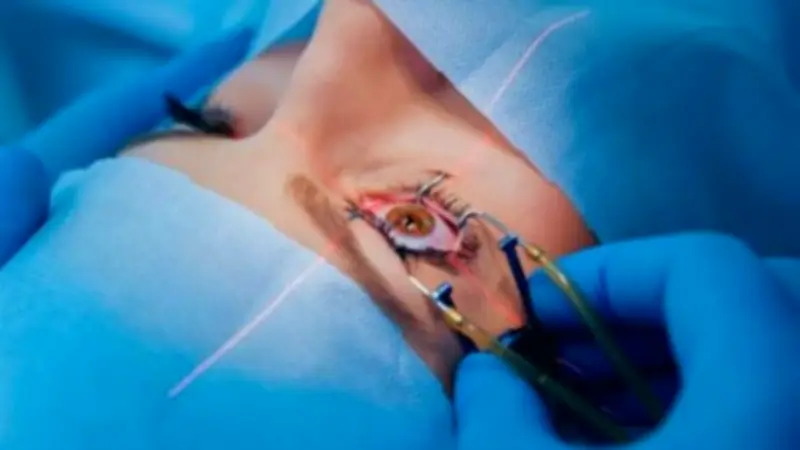 عدم تحسن الرؤية بعد عملية المياه البيضاء: الأسباب والعلاج