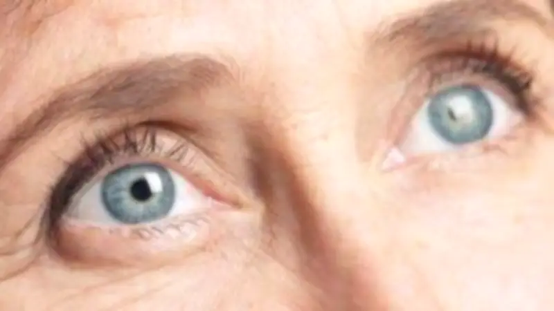 أعراض صامتة لارتفاع السكر وسبب عدم تحسن الرؤية بعد عملية المياه البيضاء