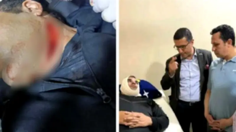 مدير مركز شباب أبو حماد يروي تفاصيل الاعتداء عليه بالسلاح الأبيض
