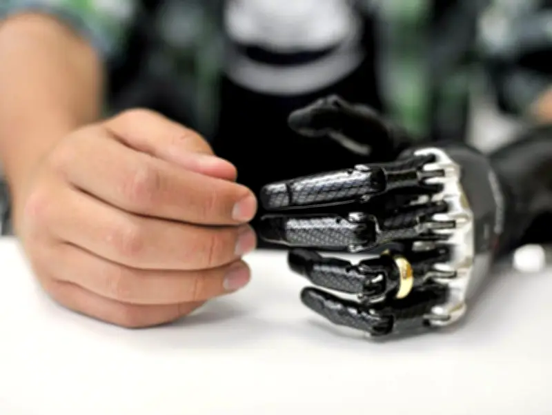 مصر تتجه لتوطين صناعة الأطراف الصناعية لتعزيز خدمات ذوي الإعاقة