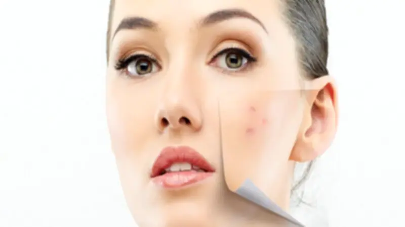 مشاكل جلدية تهددك في الصيف: طرق فعالة لحماية بشرتك