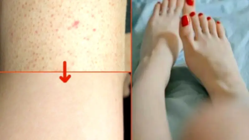 جلد الوزة: طرق فعالة للتخلص من المظهر الخشن في وقت قياسي