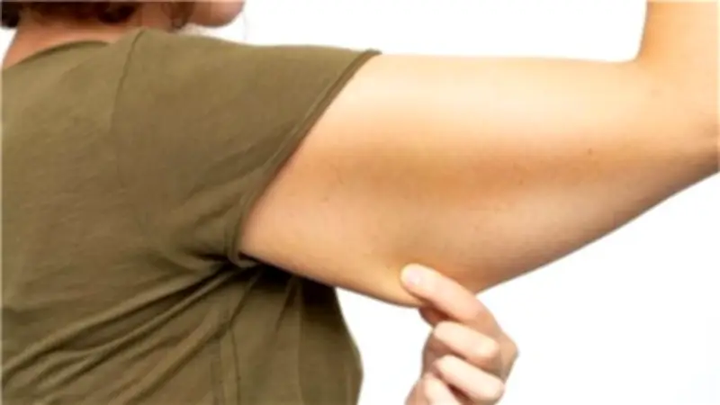 أسباب ترهل الجلد بعد فقدان الوزن الكبير.. وما الحلول المتاحة؟