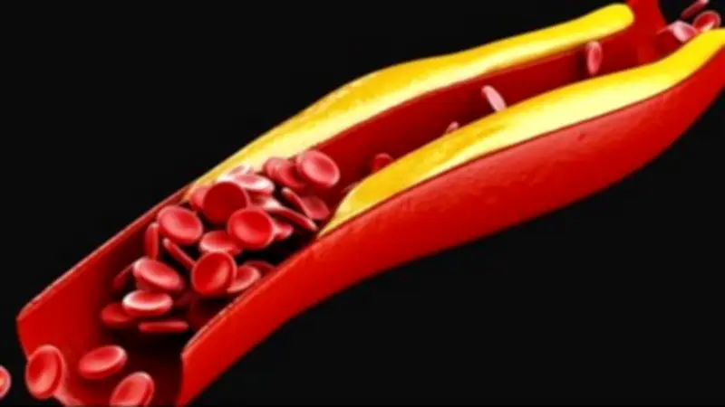 علامات في أصابع اليدين والقدمين تؤكد ارتفاع الكوليسترول بالدم