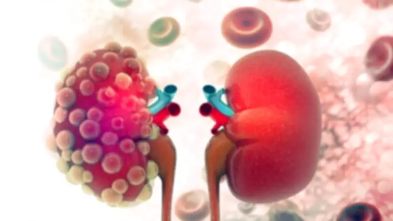 لصحة الكلى.. احرص على تناول هذا المشروب الطبيعي في الصباح لتعزيز وظائفها