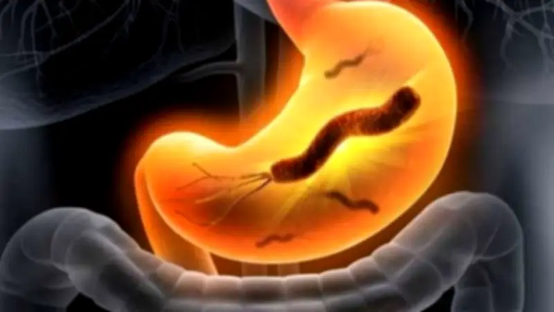 إهمال جرثومة المعدة قد يؤدي للسرطان: اكتشف الأسباب وعوامل الخطر الخطيرة