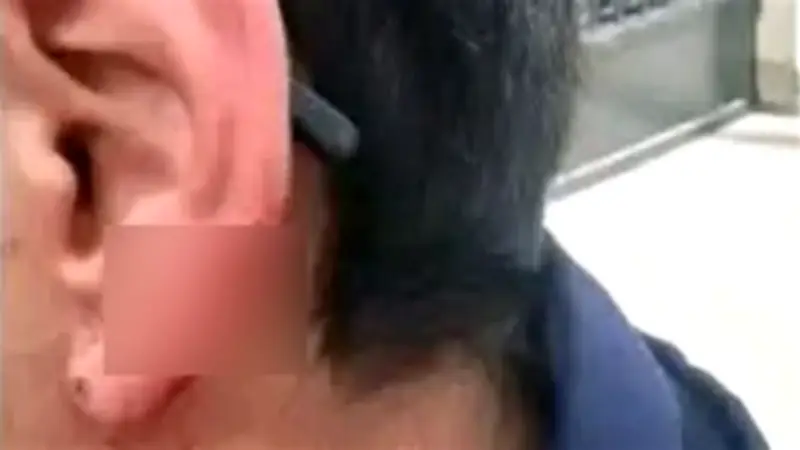 طالب يعض زميله ويقطع جزءًا من أذنه في حادثة صادمة بمدرسة الإسكندرية