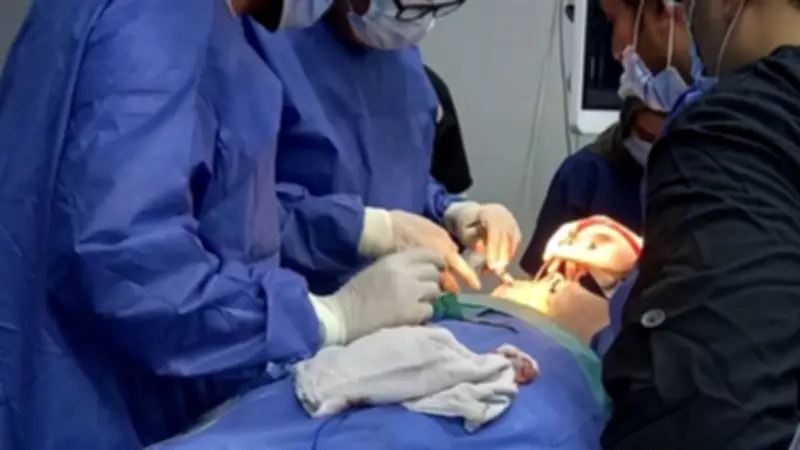 نجاح جراحة معقدة لعلاج كسر بعظام الوجه والفكين لرجل مسن في مستشفى المحلة العام