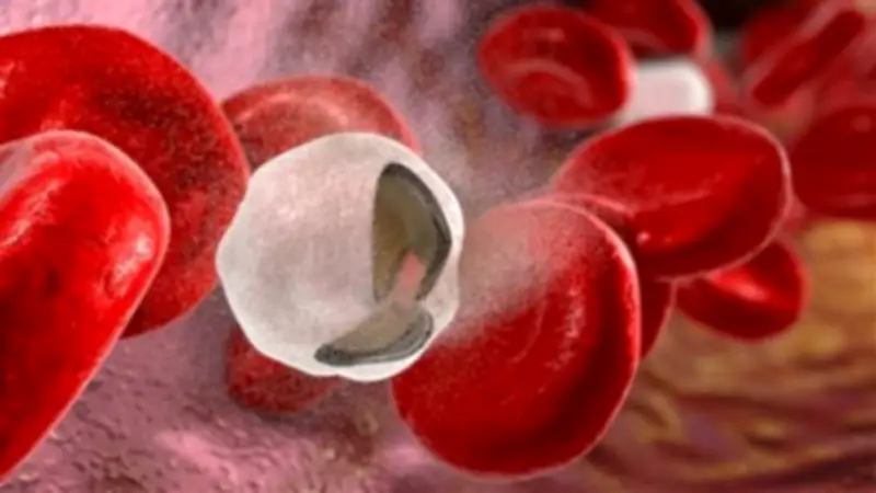 أنيميا الفول: دليل شامل للأطعمة الممنوعة والآمنة لتجنب نوبات التكسير